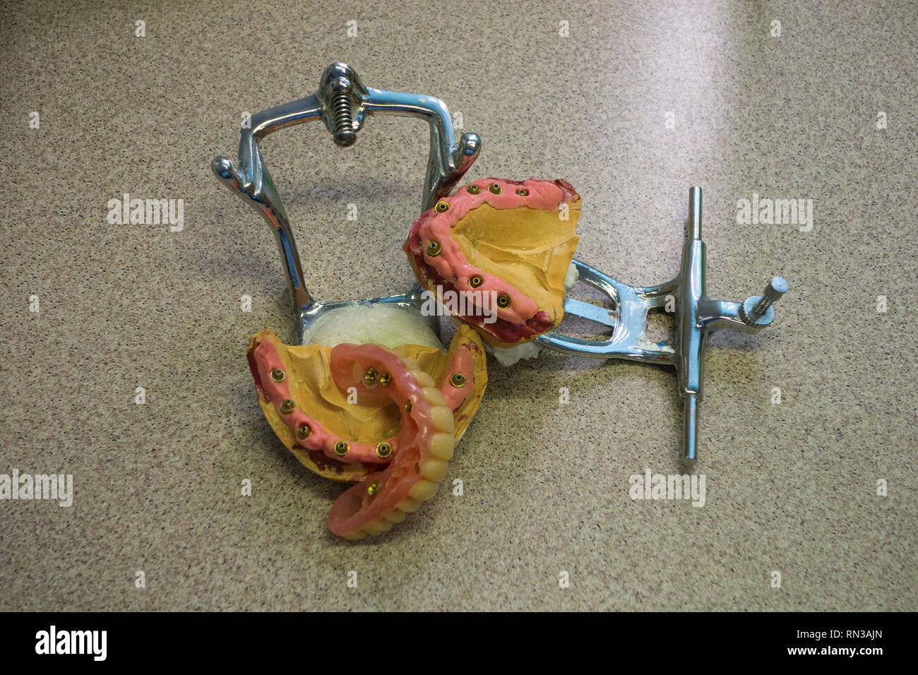 the dental plaster model with exposed dental implants Stock Photo Alamy