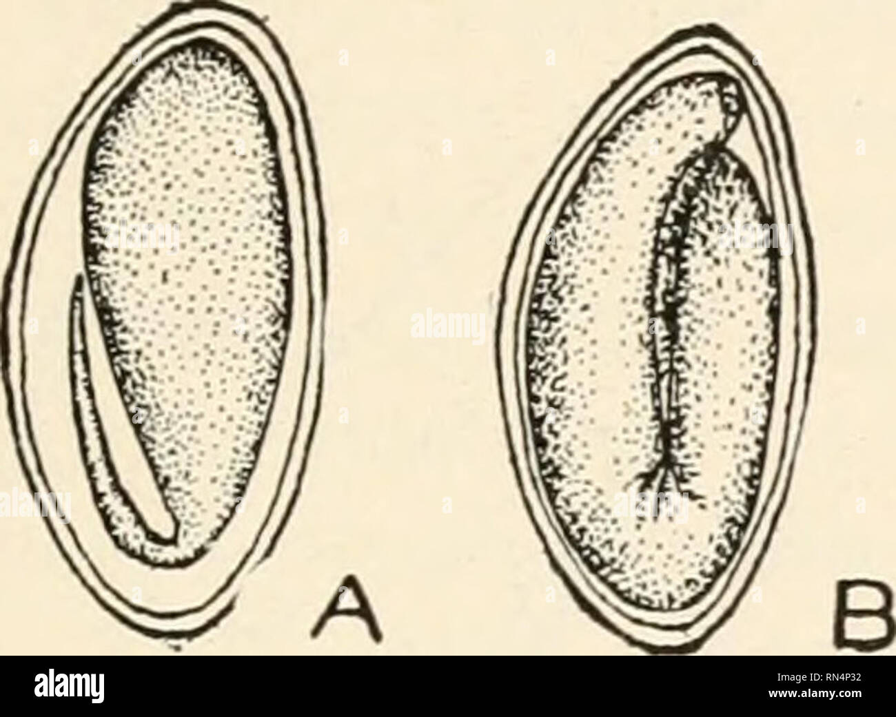 Pinworms hi-res stock photography and images - Alamy