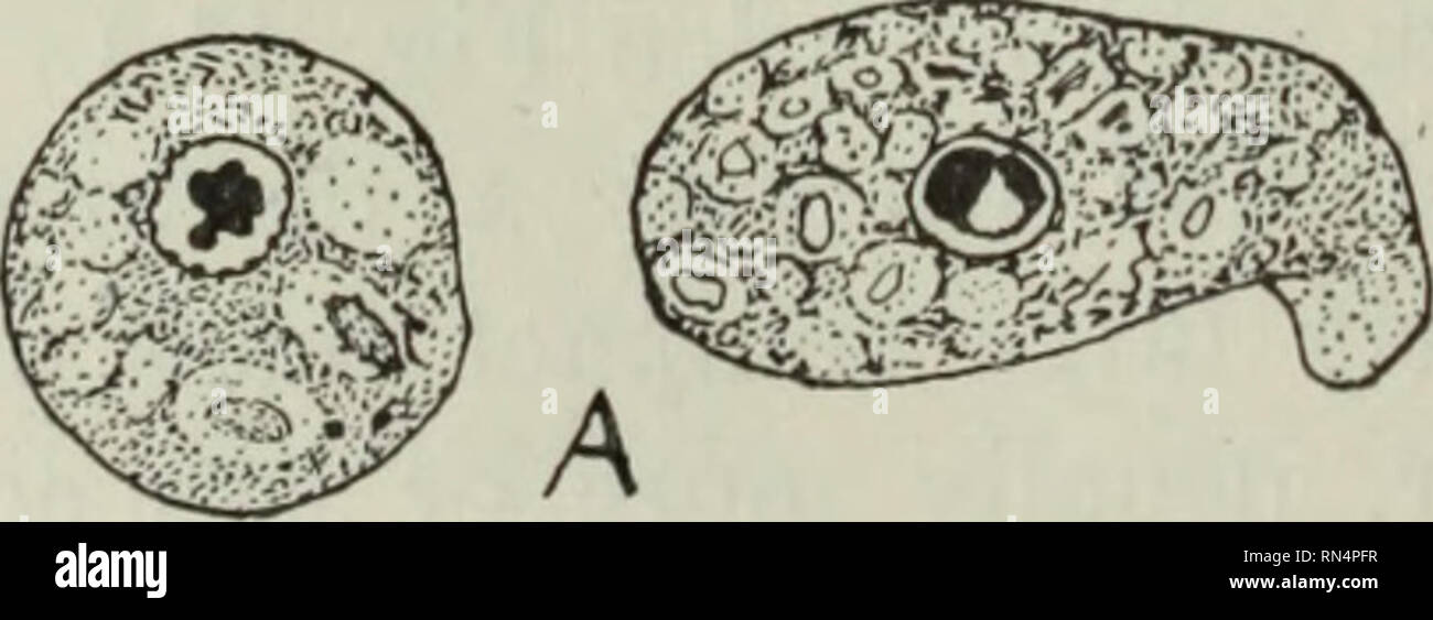 . Animal parasites and human disease. Parasites; Medical parasitology; Insects as carriers of disease. Fig. 37. Endamoeba coli. X 1650. A, stained vegetative ameba; B, cyst, with eight nuclei; n., nucleus, showing coarse peripheral chromatin granules, chromatin granules in &quot;clear zone&quot; between periphery and karyosome, and eccentric karyosome; chr. b., remnant of chromatoid body. Note large number of food vacuoles in vegetative ameba. (After Dobell.). Please note that these images are extracted from scanned page images that may have been digitally enhanced for readability - coloration Stock Photo