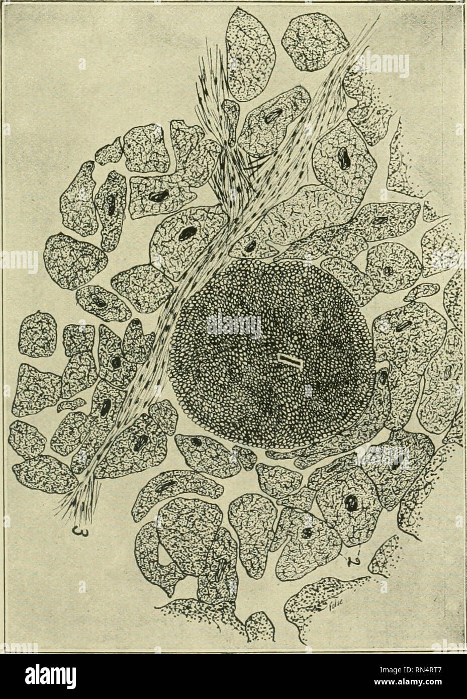 . Animal parasites and parasitic diseases. Domestic animals; Veterinary medicine. PARASITOLOGY. 185. Fig. 72—Sarcocystis Miescheki, Drawing made with Camera lucida. 1, Cross section sarcocyst, muscle cell enclosing sarcocyst ruptured. 2, Cross section of heart mugcle cell. 3, Fibrous connective tissue.. Please note that these images are extracted from scanned page images that may have been digitally enhanced for readability - coloration and appearance of these illustrations may not perfectly resemble the original work.. Kaupp, B. F. (Benjamin Franklyn), 1874-. Chicago, A. Eger Stock Photo