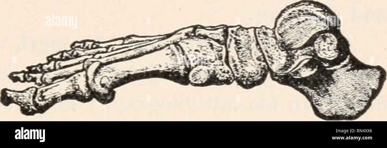 Aversion to activity hi-res stock photography and images - Alamy