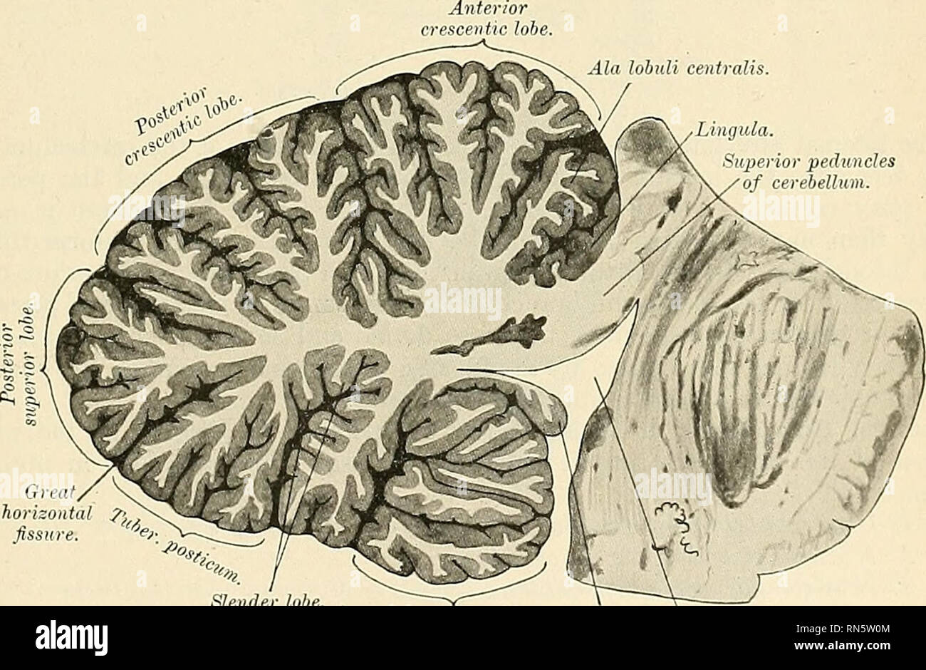 lingula cerebellum
