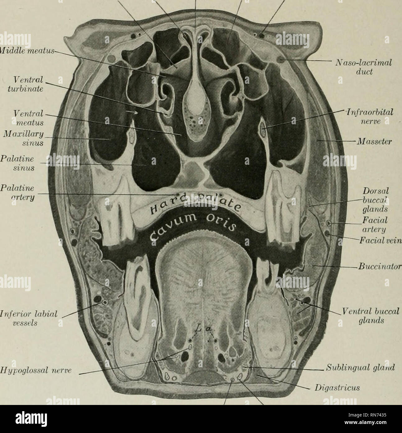 ANAT 411 Anterior View of the Muscles of Head & Neck Diagram