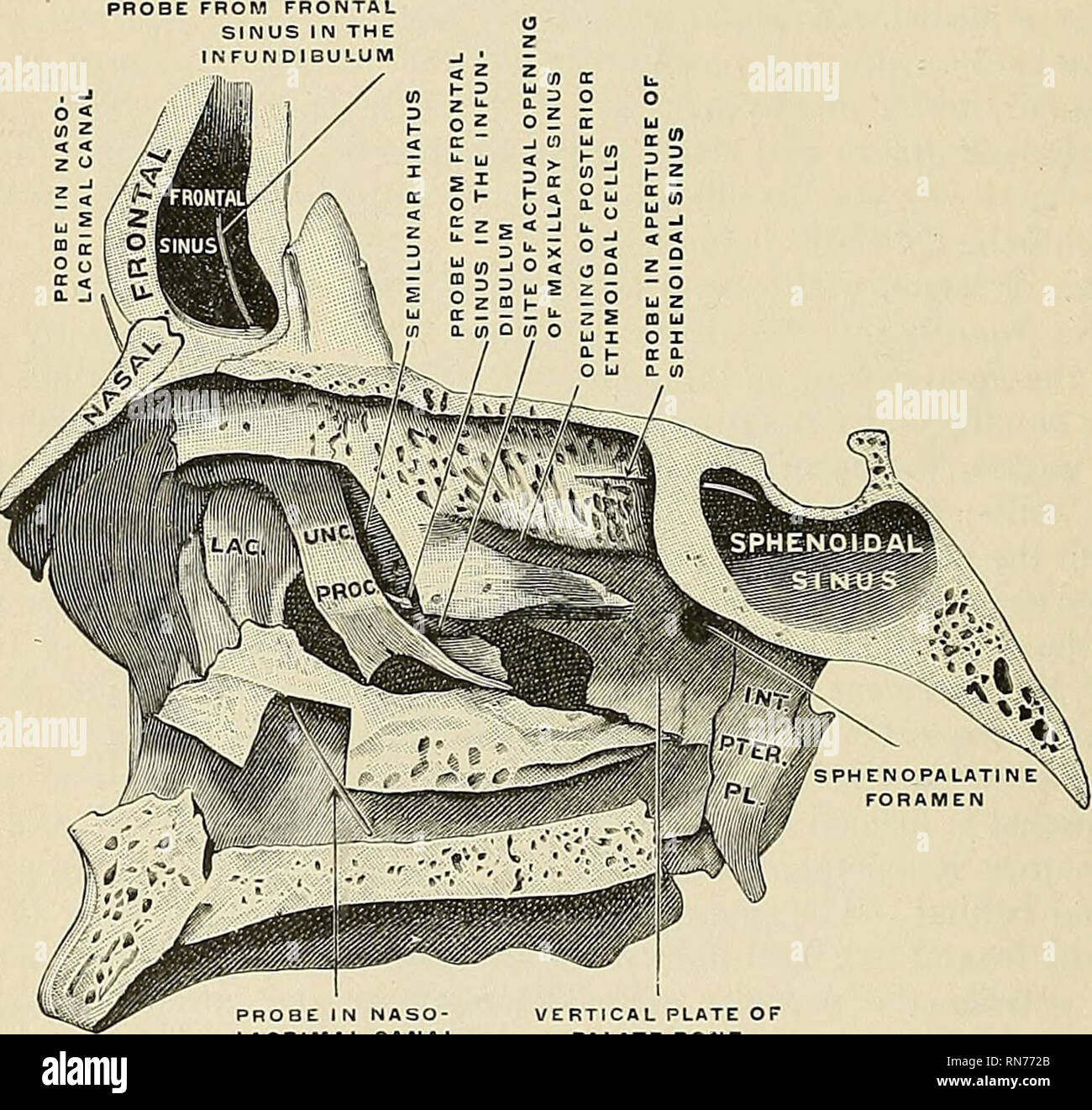 Posterior Ethmoidal Foramen