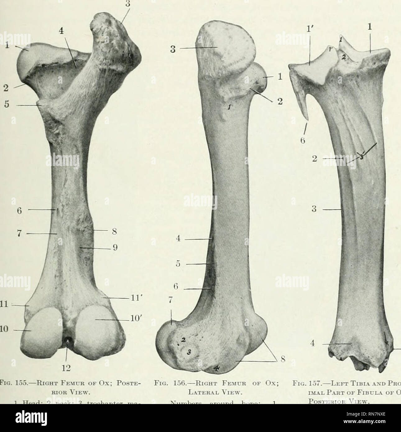 Trochanteric Fossa