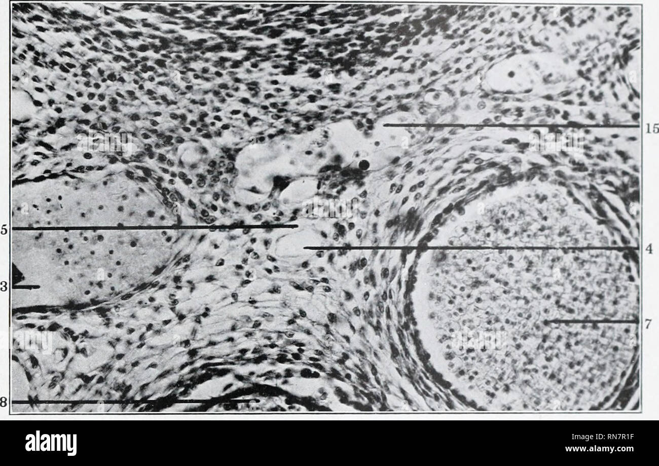 . The anatomy and development of the systemic lymphatic vessels in the ...