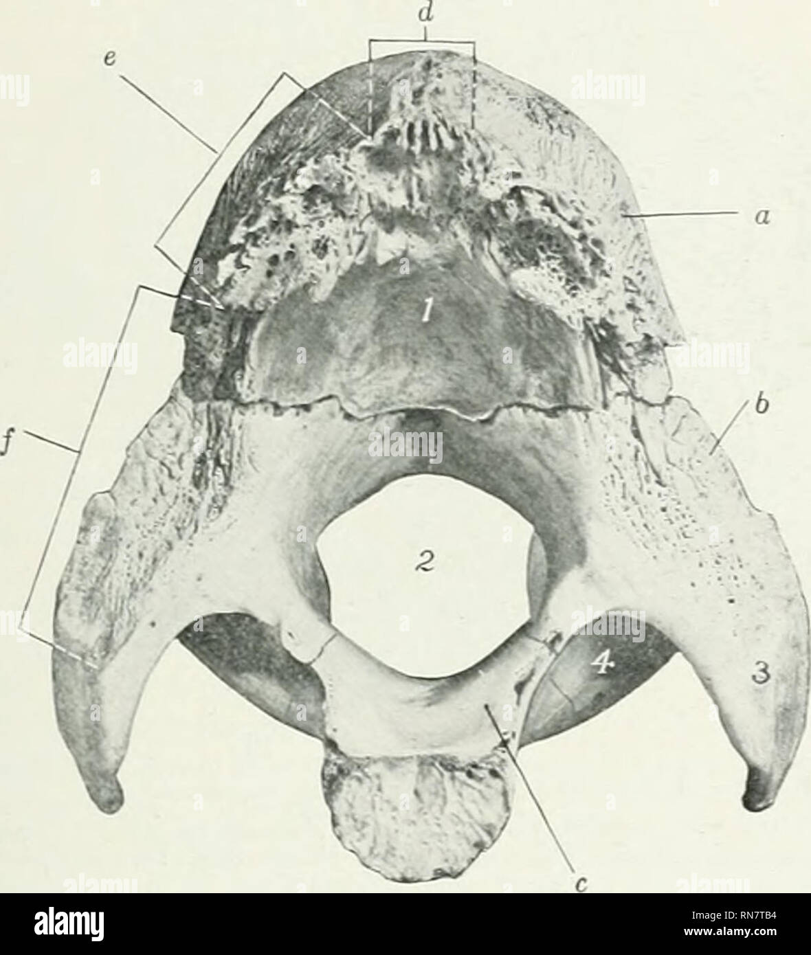 Occipital Bone Foramen Magnum 0587