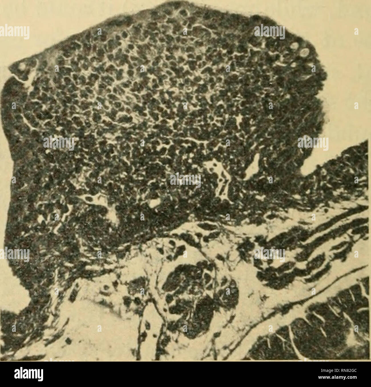 . Anatomischer Anzeiger. Anatomy, Comparative; Anatomy, Comparative. Fig. 3. Eig. 4. Fig. 3. Sublingual tonsil. Salamandra atra. Drawing from a vertical section, to show the cells in the epithelium, connective tissue, blood-vessels, etc. V. vein. Fig. 4. Sublingual Tonsil. Salamandra atra. Photograph, x 90, to show the structure and relations. of a sublingual tonsil and photographs of a sublingual and a preglotti- deal tonsil, figures 1, 2 and 3. Figure 6 shows a small nest of round cells in the epithelium. It is quite possible that through structures in the epithelium of this character, a con Stock Photo