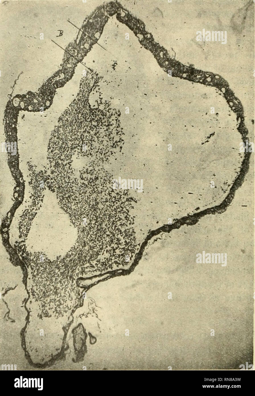 6 week embryo hi-res stock photography and images - Alamy