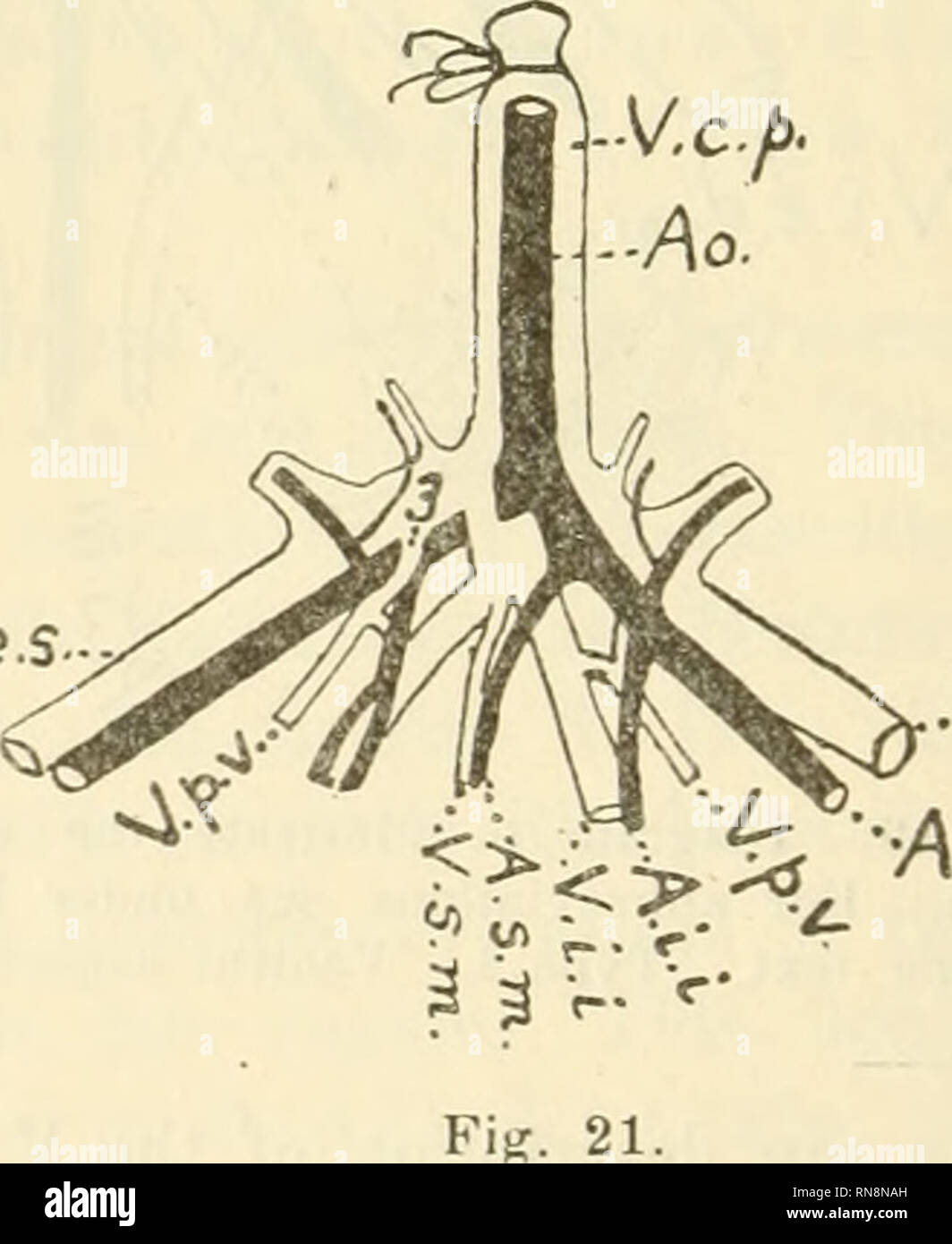 . Anatomischer Anzeiger. Anatomy, Comparative; Anatomy, Comparative. Fig. 20 The manner in which this vein is connected with the Vv. iliacae is extremely variable in Didelphys. In order to best understand these variations the following Diagram is appended. In the Diagram (Fig. 19) the V. pudendo-vesicalis (V.p.v.) is seen to open, on each side, into the angle of union of four veins. Two of these veins open into the Vv. iliacae internae, while the remaining two open into the Vv. iliacae externae. The anterior pair of these veins, numbered 1 and 2, lie ventral, and the posterior pair, numbered 3 Stock Photo