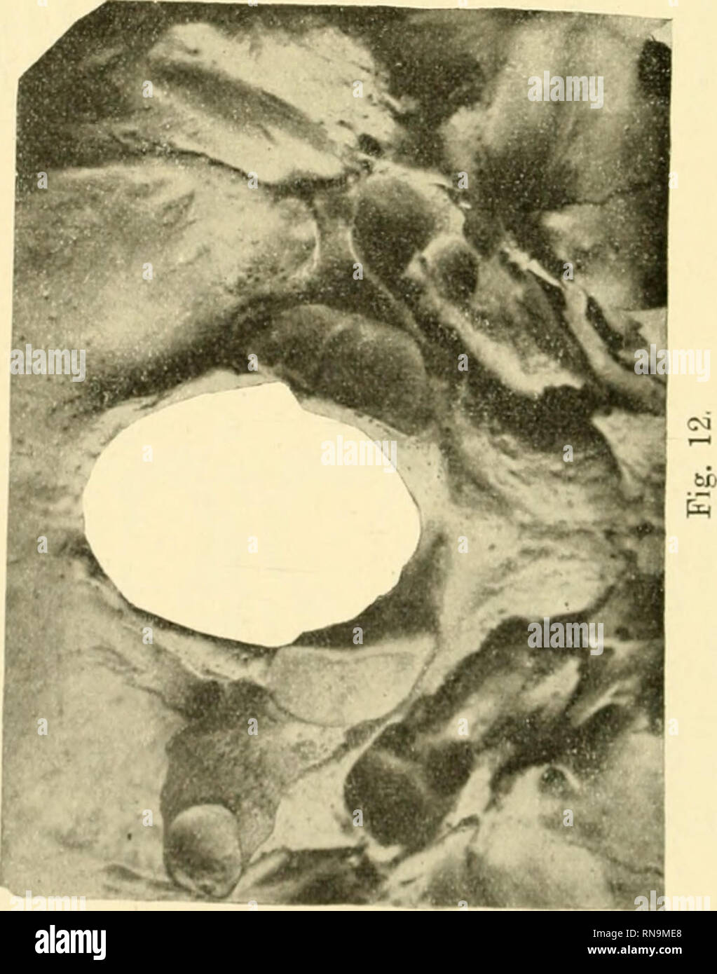 Anatomische Hefte P C A 9 Rt S Amp S C L 3 D C 9 9 Cd Rt 2 9 P O Quot 3