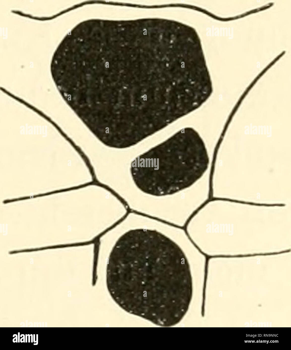 . Anatomische Hefte. . Fig. 3. Natürliche Grösse. Fig. 4. Va natürlicher Grösse. mechanismus heranziehen zu müssen, und da sich der Einfluss desselben in einem von Zuckerkandl pubhzierten Falle zweifellos erkennen lässt, halte ich mich für berechtigt, auch diesen Fall zu verwerten. Das in Tafelfig. 1 abgebildete Brustbein bietet Veränderungen nur ganz geringen Grades dar. Die zweite Rippe und ebenso. Please note that these images are extracted from scanned page images that may have been digitally enhanced for readability - coloration and appearance of these illustrations may not perfectly rese Stock Photo