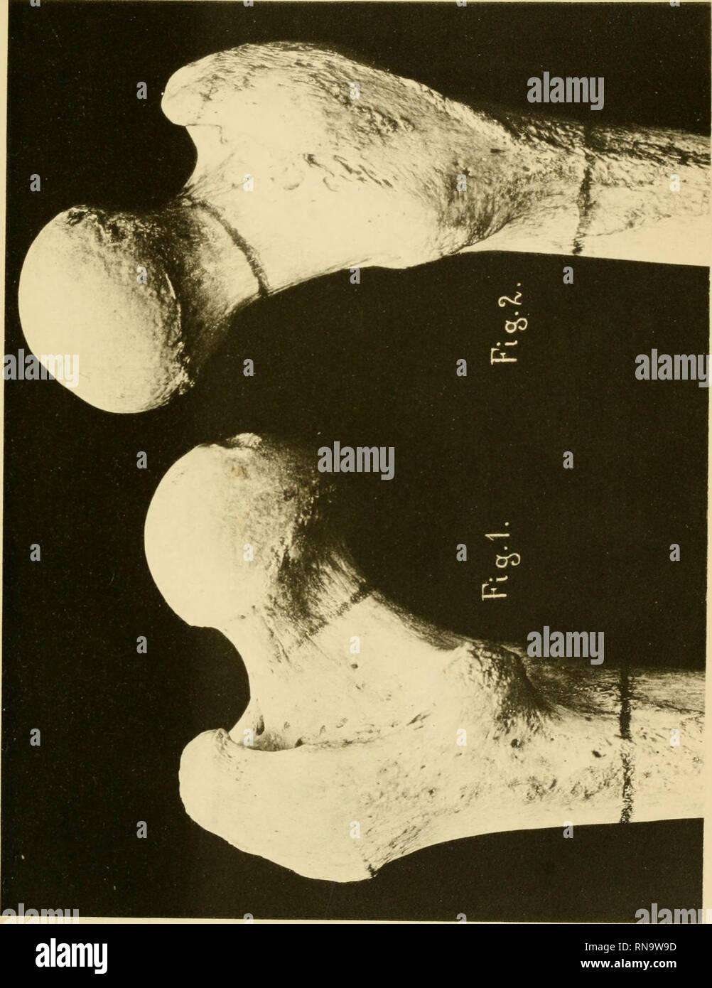 Anatomische Hefte Anatomische Hefte I Abteilung Heft 37 11 Bd