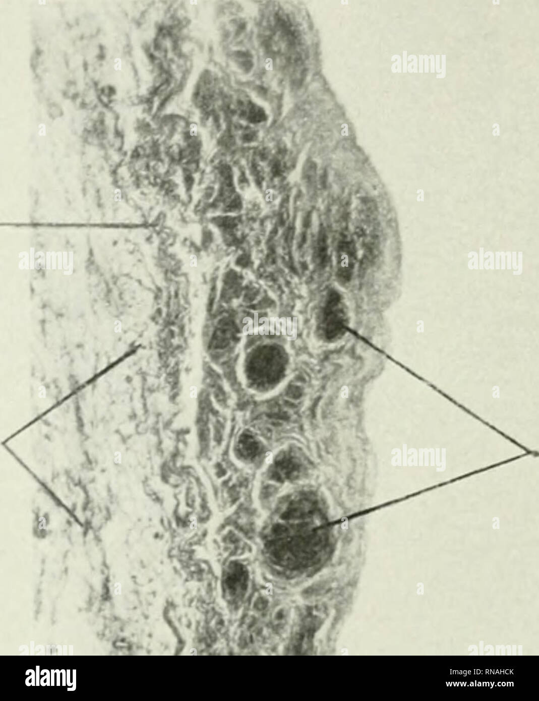 Elastic lamellae hires stock photography and images Alamy