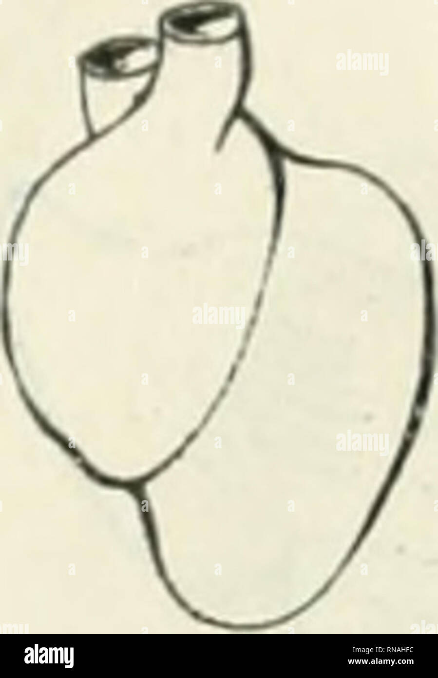 The Anatomical Record Anatomy Anatomy Fig 2 Outline Of The Anterior Side Of A Normal Heart From An Embryo 14 Mm Long No 360 Fig 3 Normal Heart Anterior View From Glenn barnhart talks about what the normal heart looks like. alamy