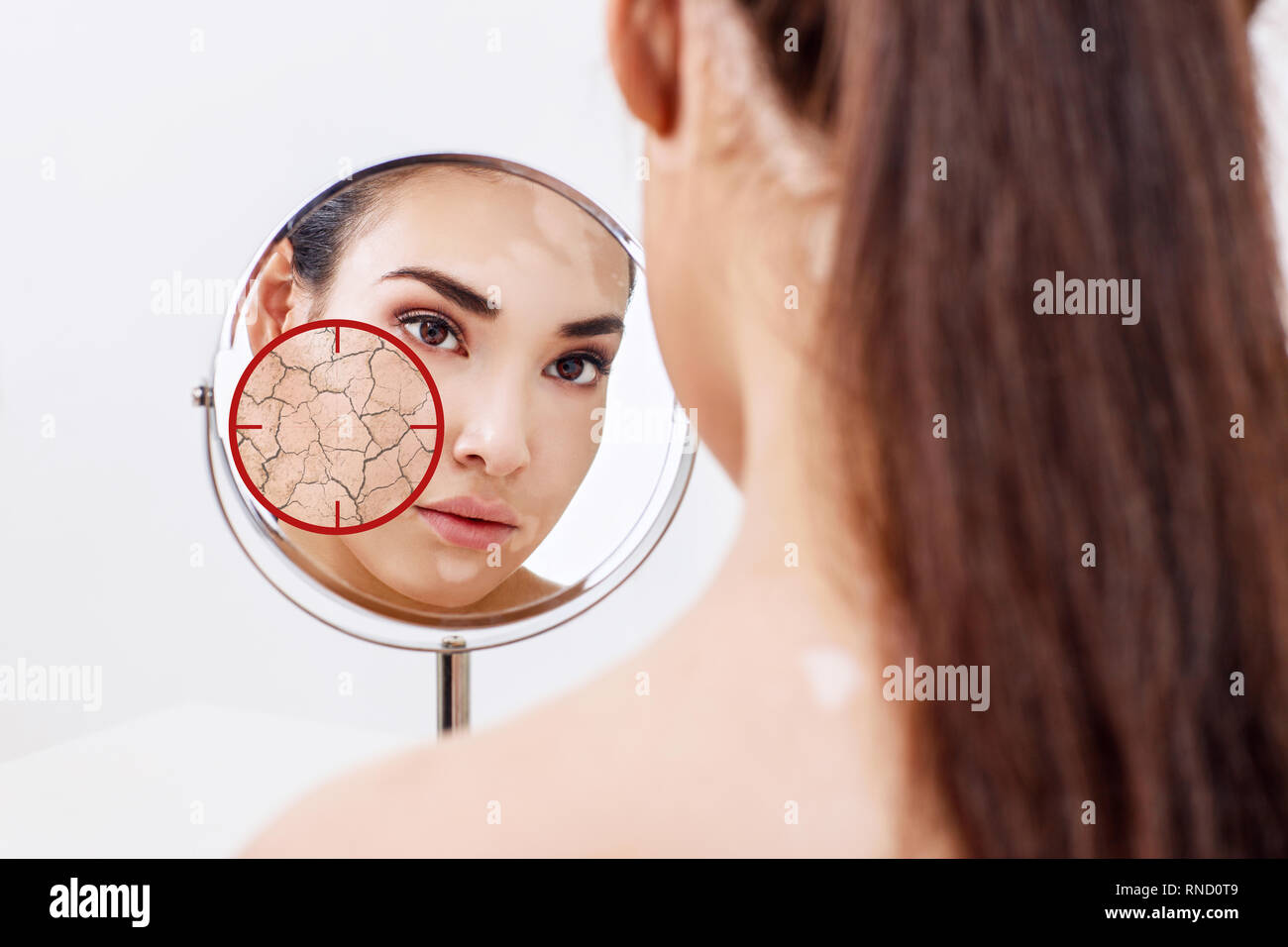 Red aim shows dry facial skin before moistening. Stock Photo