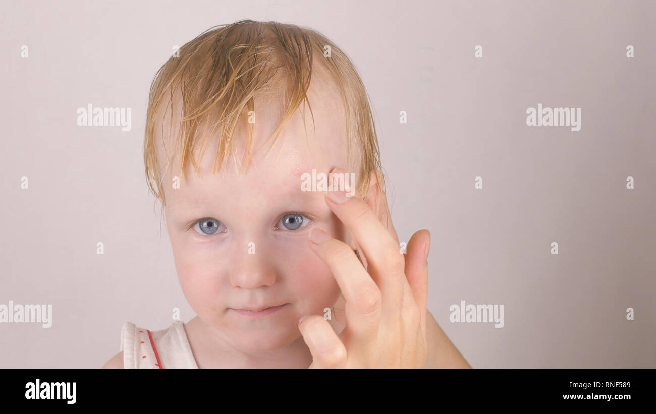 Mother treats a scar wound on the forehead of her little caucasian