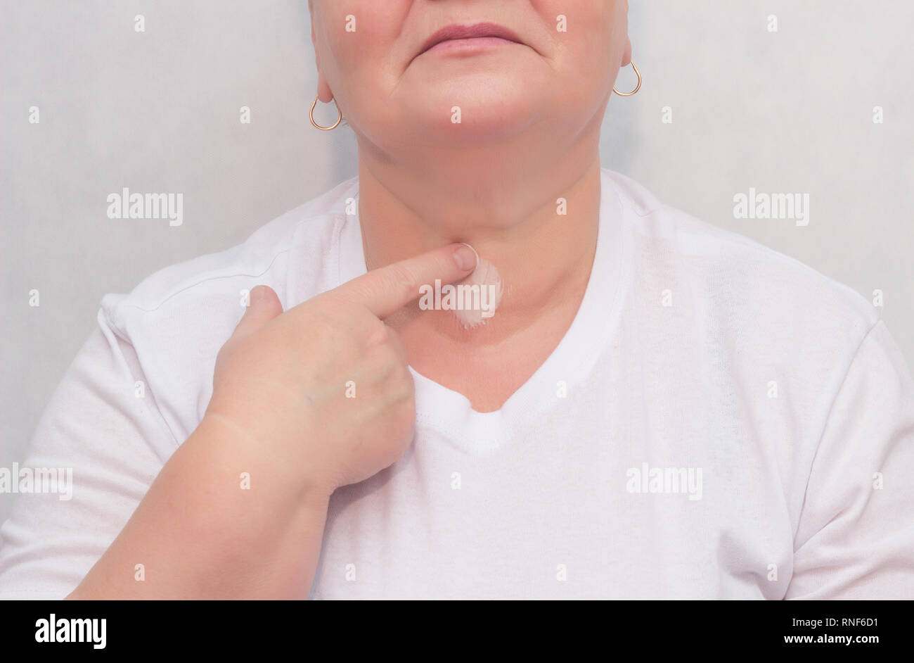 Woman rubs therapeutic cream-gel for the thyroid gland, treatment of the thyroid gland, close-up, therapeutic, medicinal, endocrine system Stock Photo