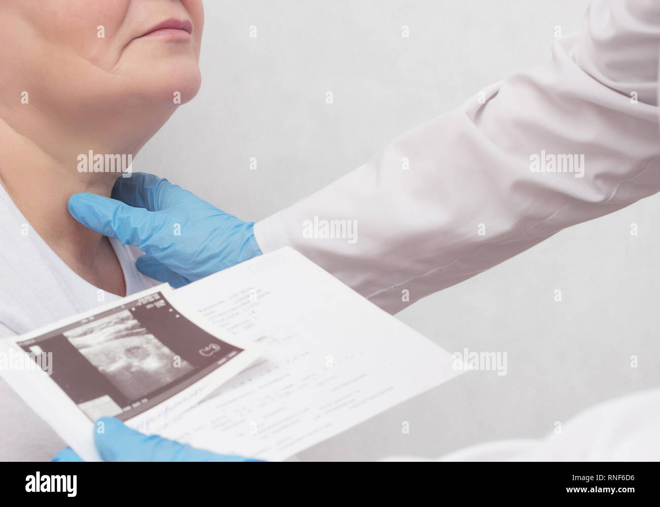 A woman is on reception at the endocrinologist, the doctor looks at the results of an ultrasound scan of the thyroid gland, close-up, carcinoma, endoc Stock Photo