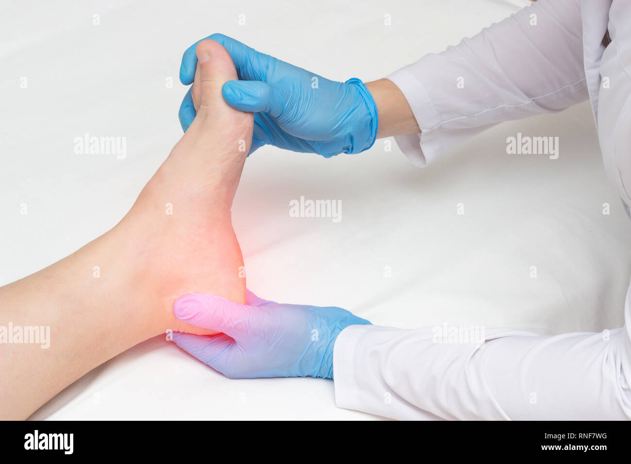 Doctor examines the sore heel of a woman who has a heel spur, plantar fasciitis Stock Photo