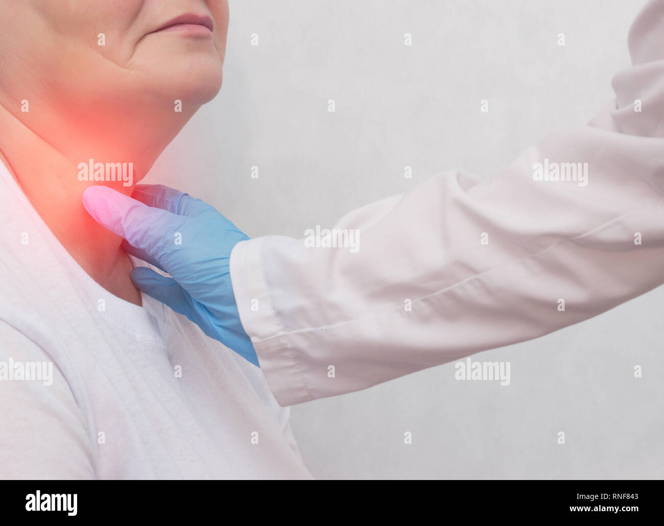 Adult woman on reception at the doctor who has problems with the thyroid gland and the endcrine system, close-up, patient, carcinoma, symptom Stock Photo