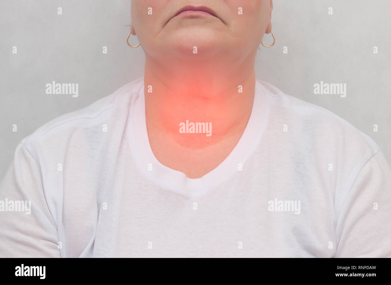 Adult woman on a white background which has a thyroid gland, nodes in the thyroid gland, close-up, Thyrotoxicosis, Hypothyroidism, hypophysis Stock Photo