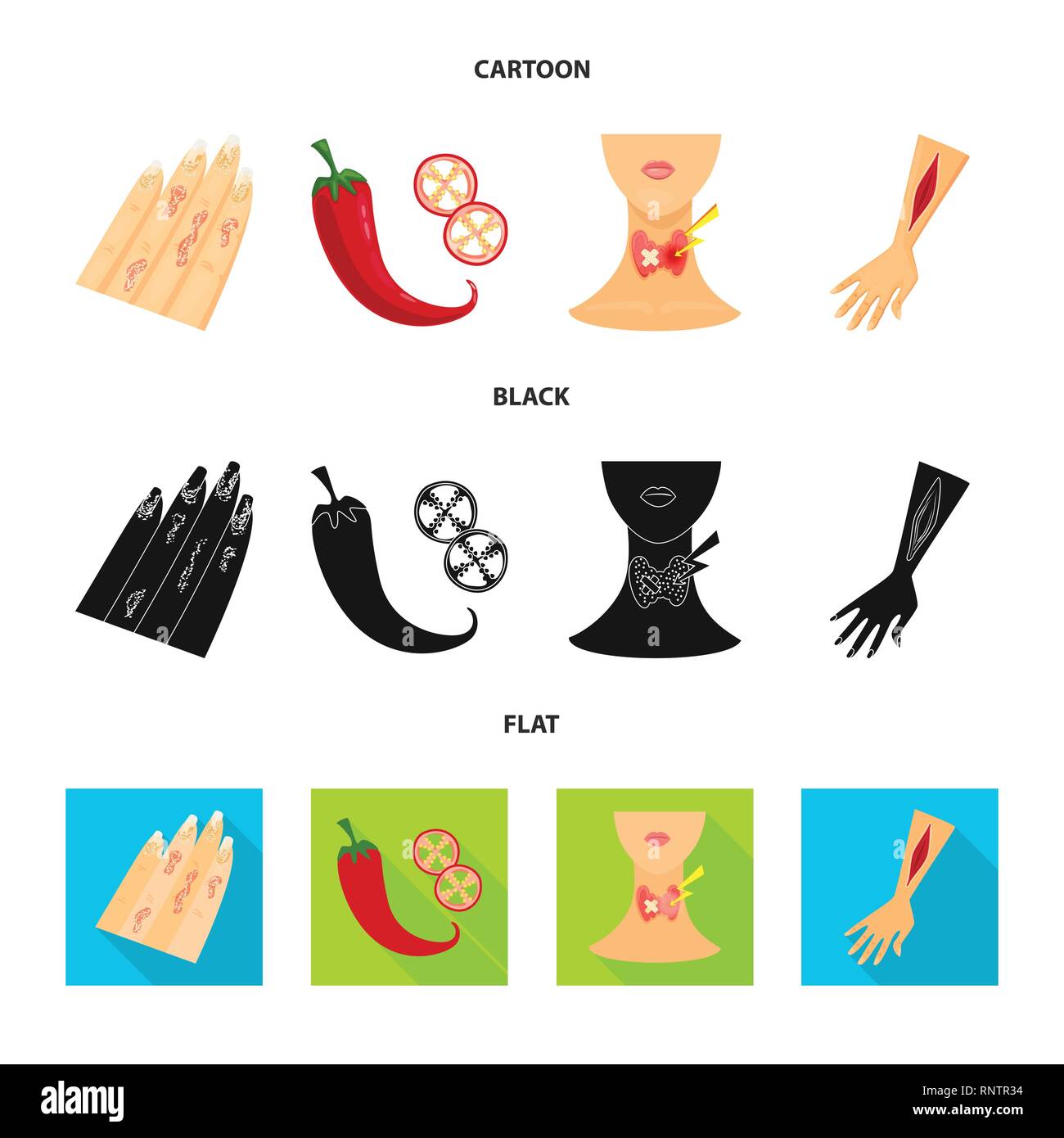 psoriasis,pepper,endocrine,injury,body,chili,system,arm,skin,hot,neck