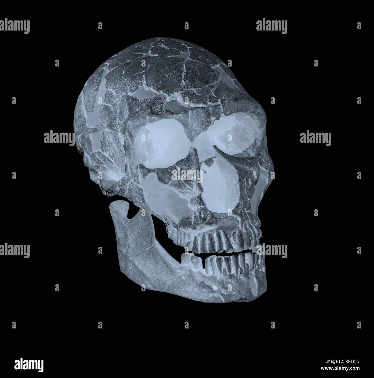 Side face skull x-ray image Stock Photo