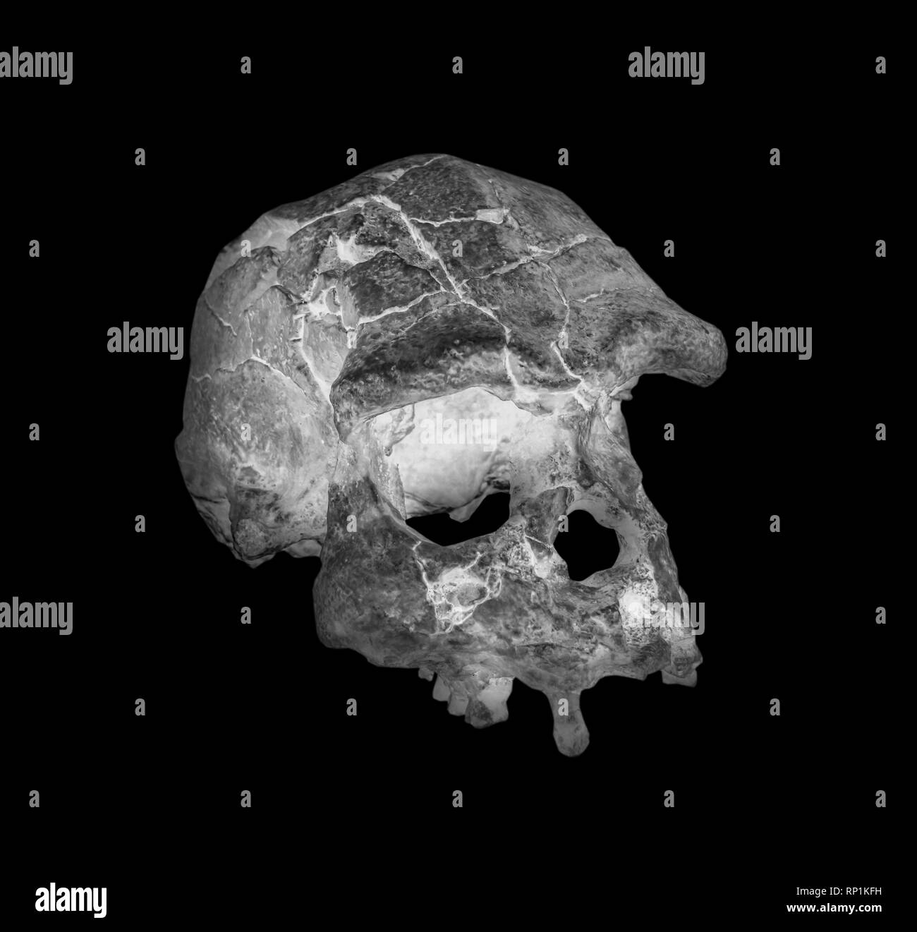 Side face skull x-ray image Stock Photo