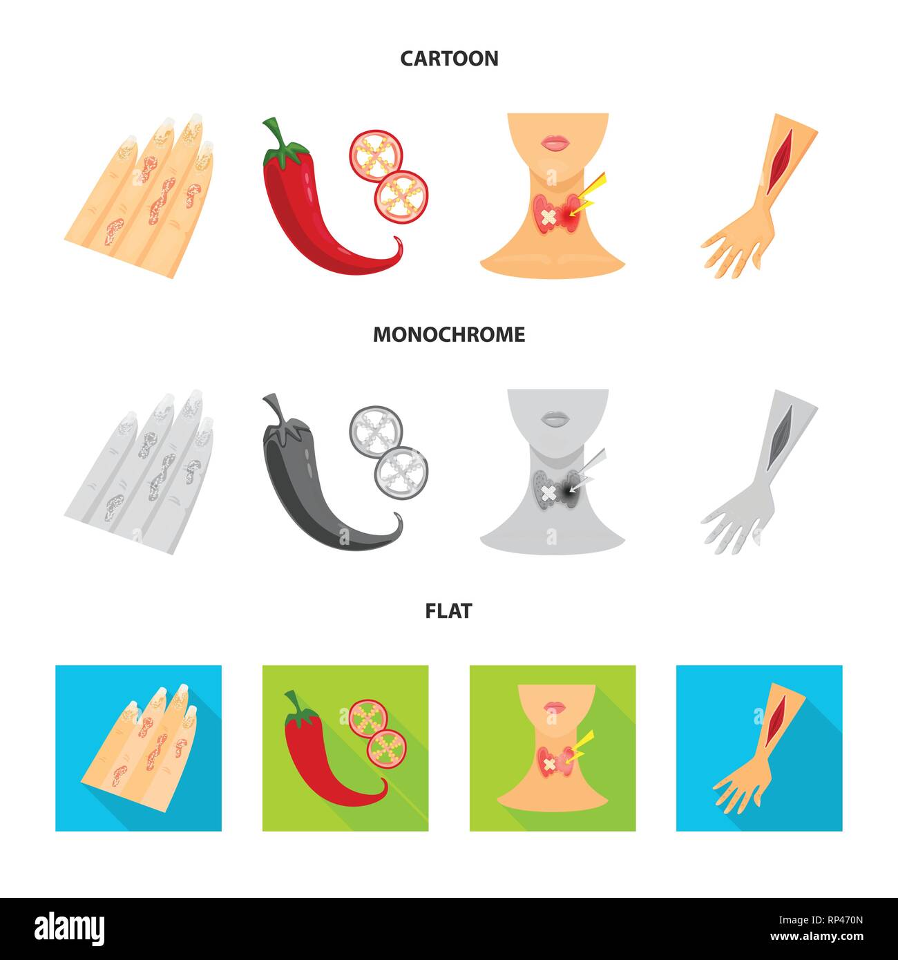 psoriasis,pepper,endocrine,injury,body,chili,system,arm,skin,hot,neck ...