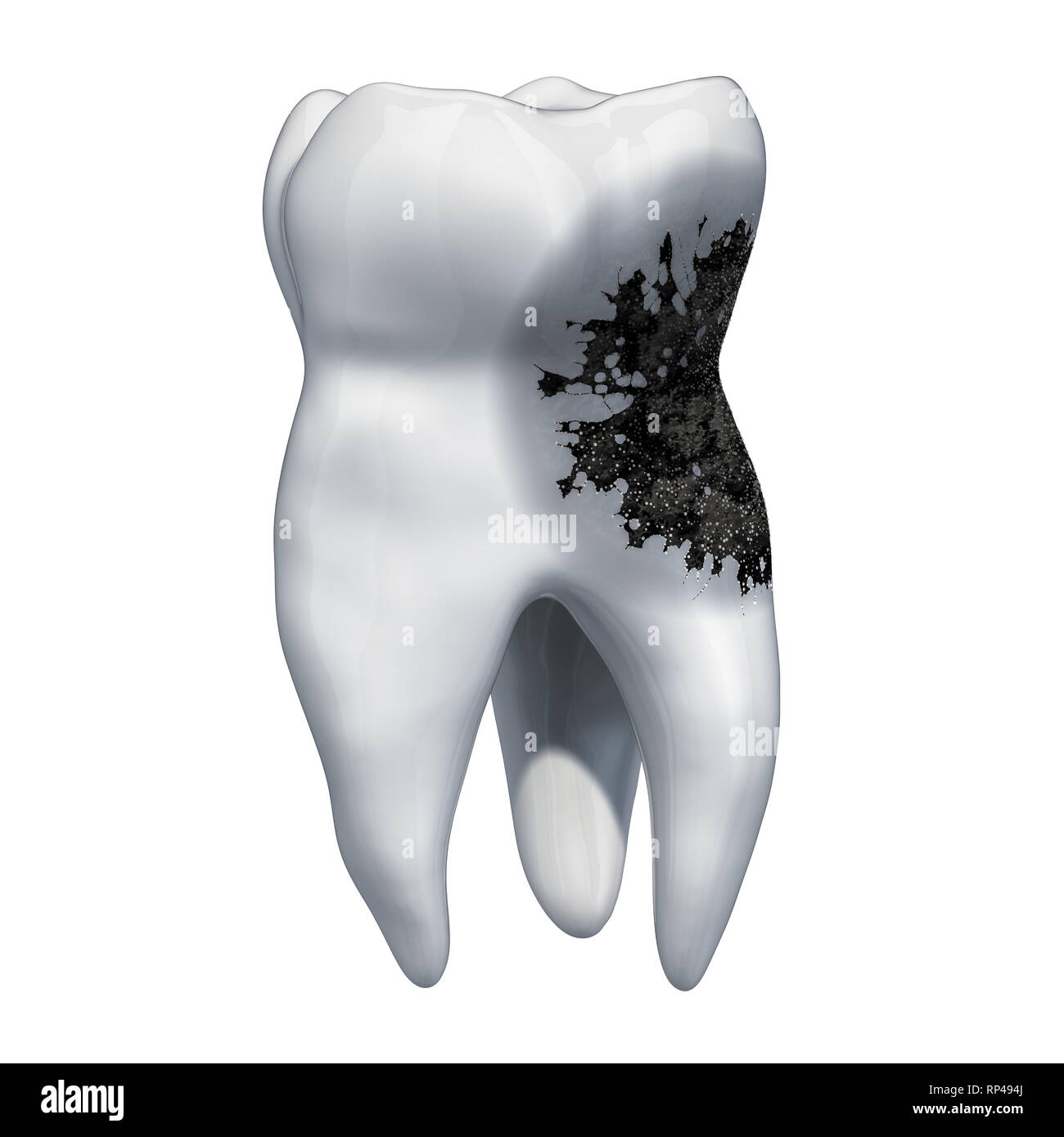Tooth with caries, toothache concept. 3D rendering isolated on white ...