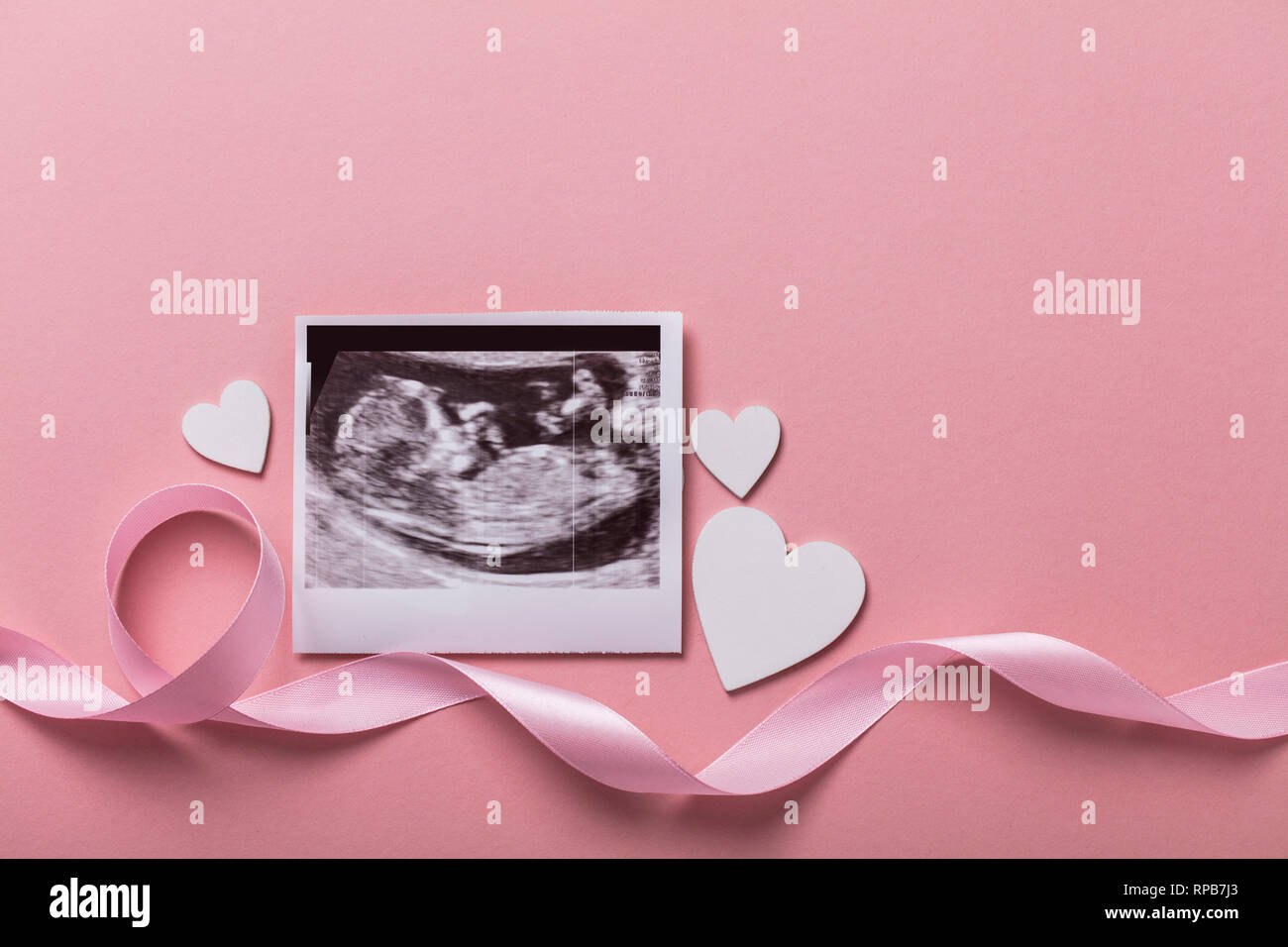 Baby scan ultrasound picture. Expectant parents concept Stock Photo