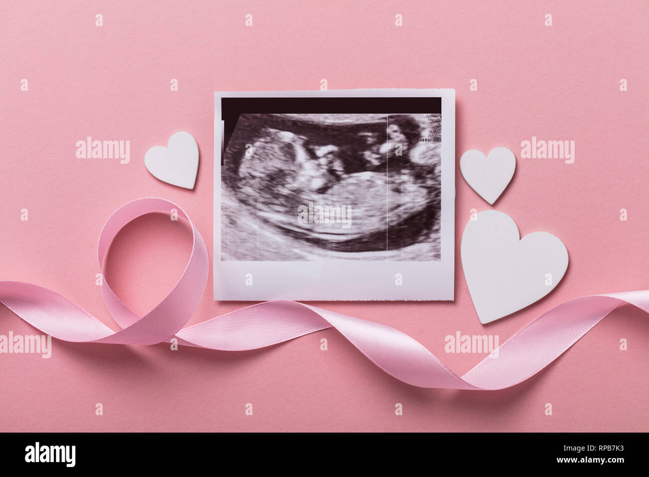 Baby scan ultrasound picture. Expectant parents concept Stock Photo Alamy