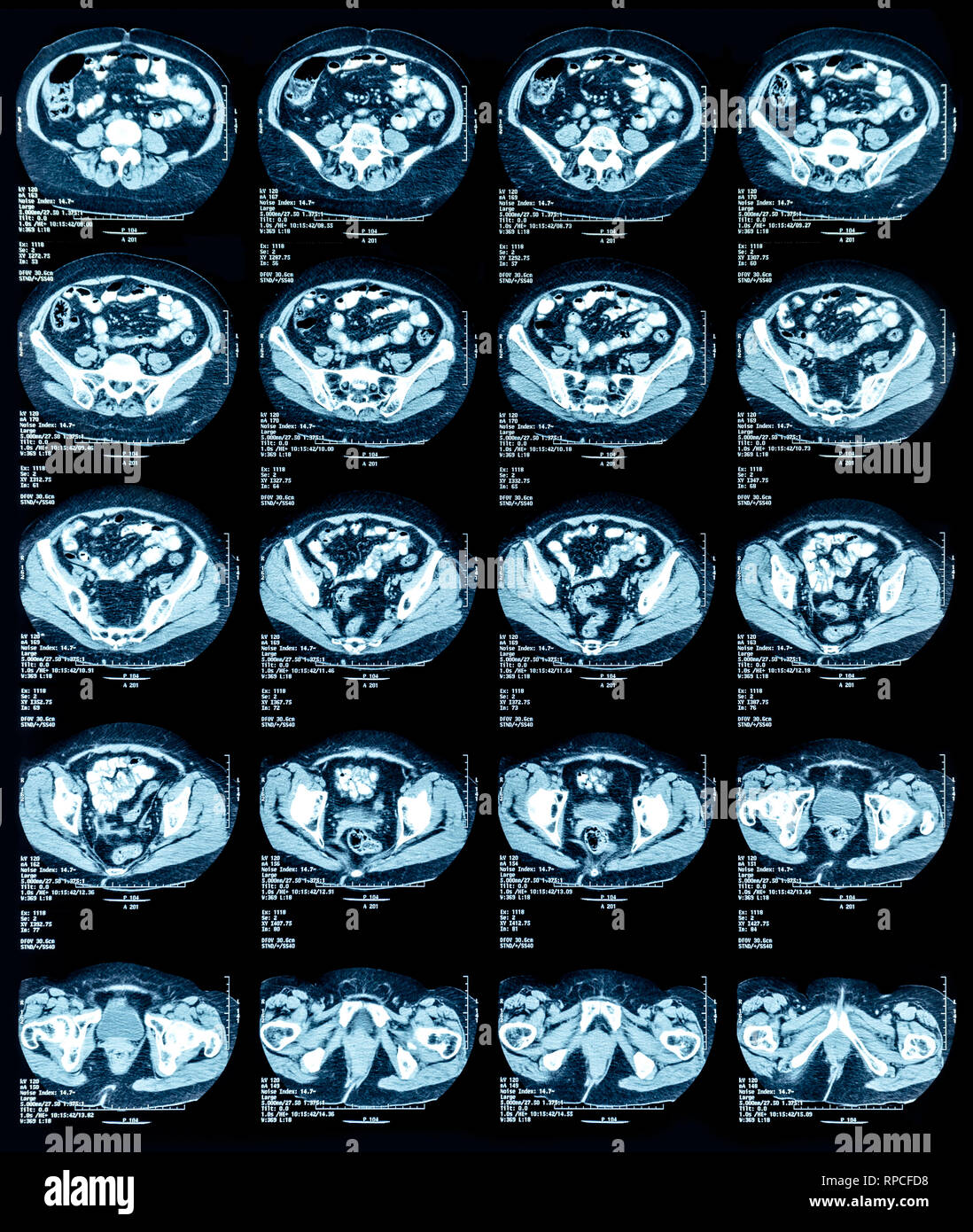 Magnetic Resonance Image (MRI) of chest and abdomen Stock Photo