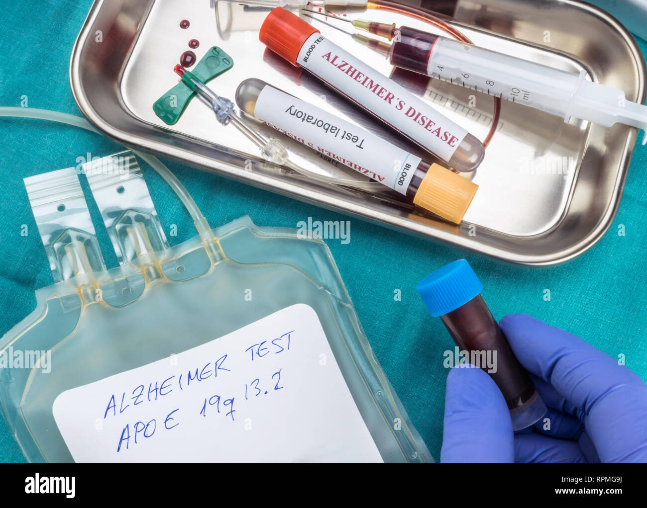 blood sample to investigate remedy against Alzheimer's disease, conceptual image Stock Photo