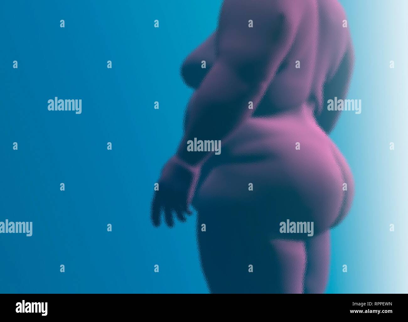 Obese woman, conceptual illustration. Stock Photo