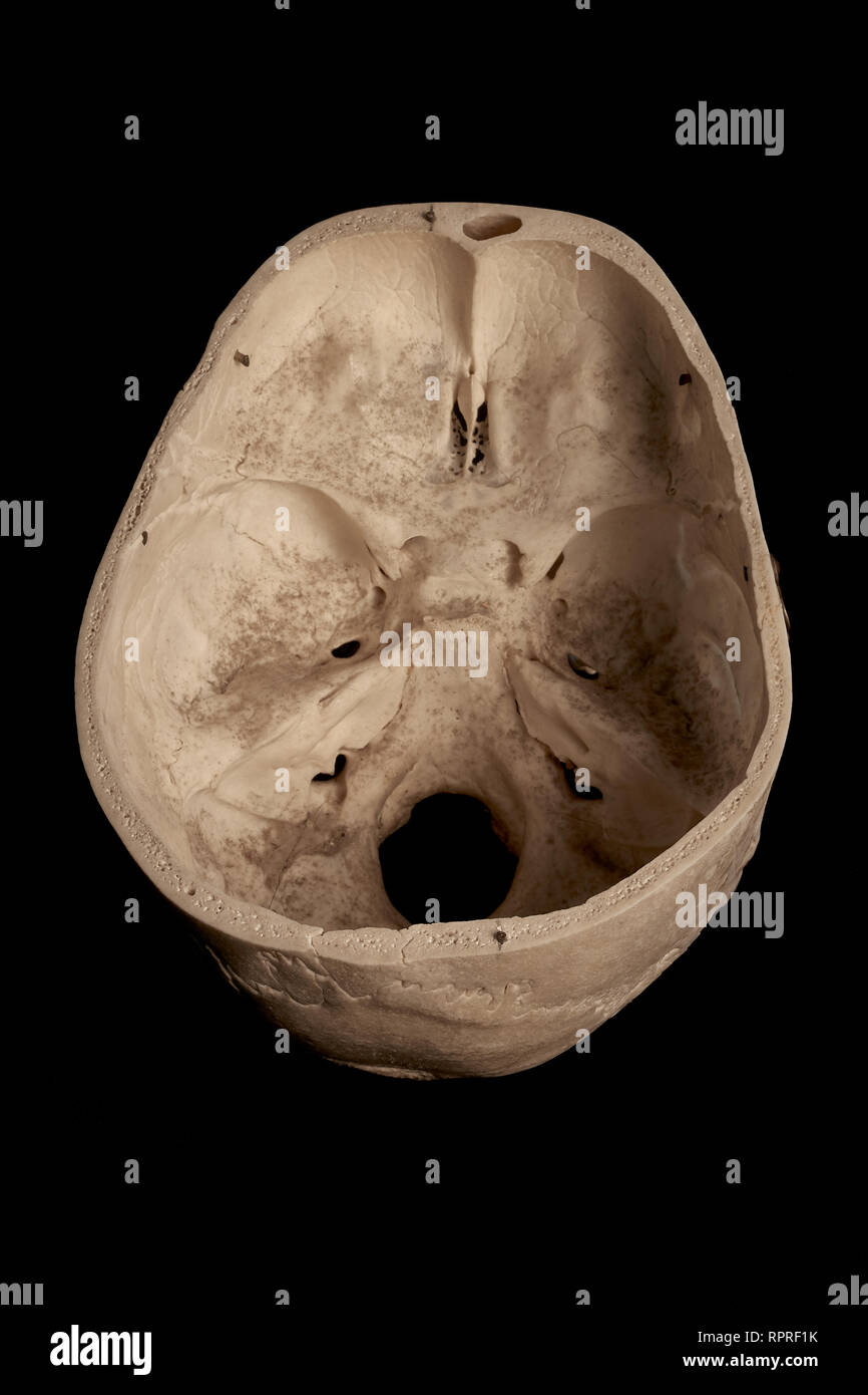 Interior View Of A Human Skull From Above Against A Black