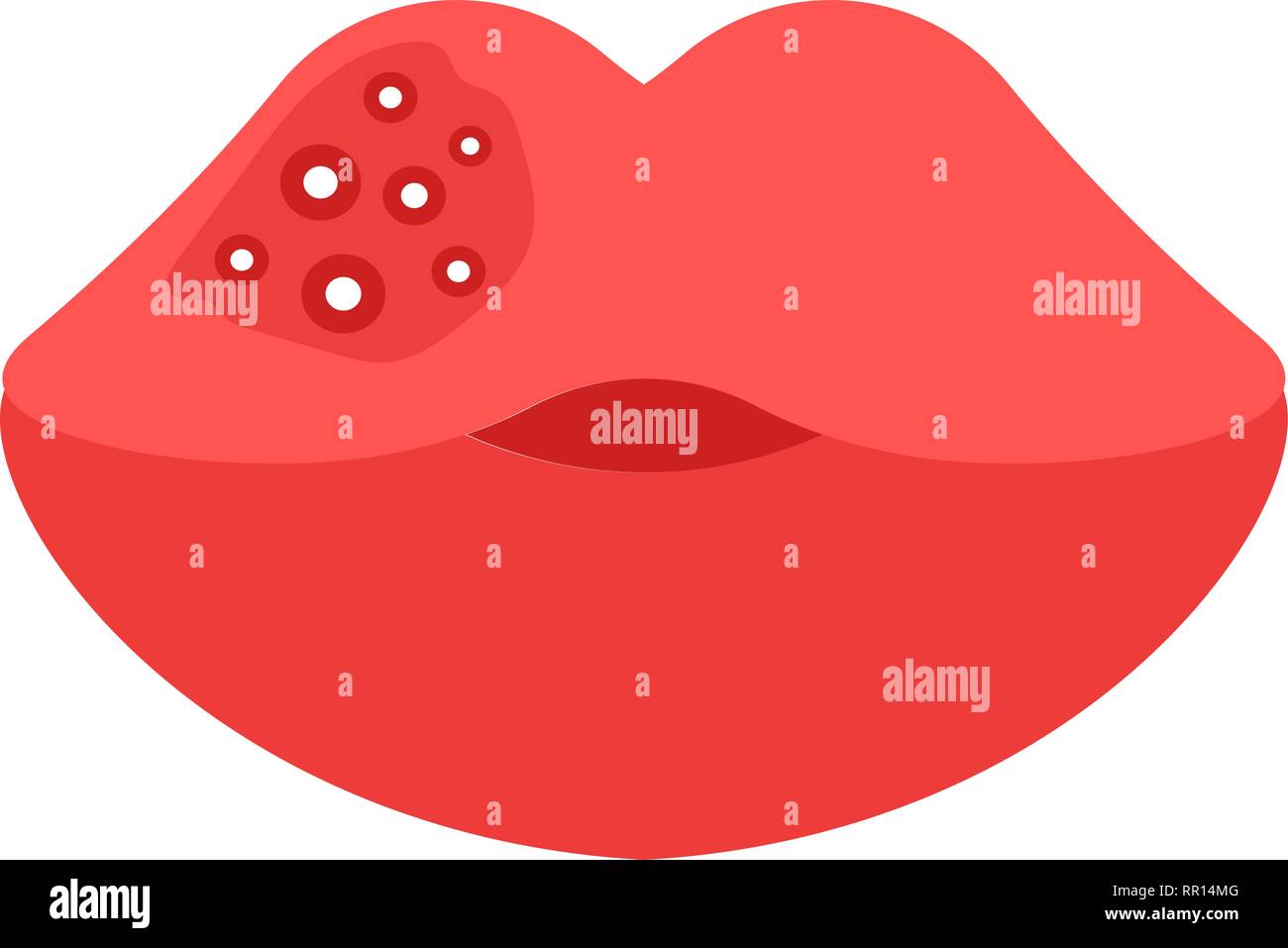 Herpes zoster face Stock Vector Images - Alamy