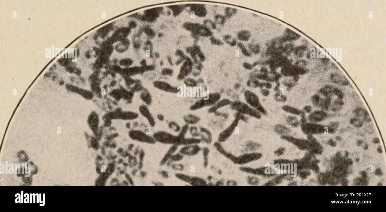 Botulism toxin hires stock photography and images Alamy