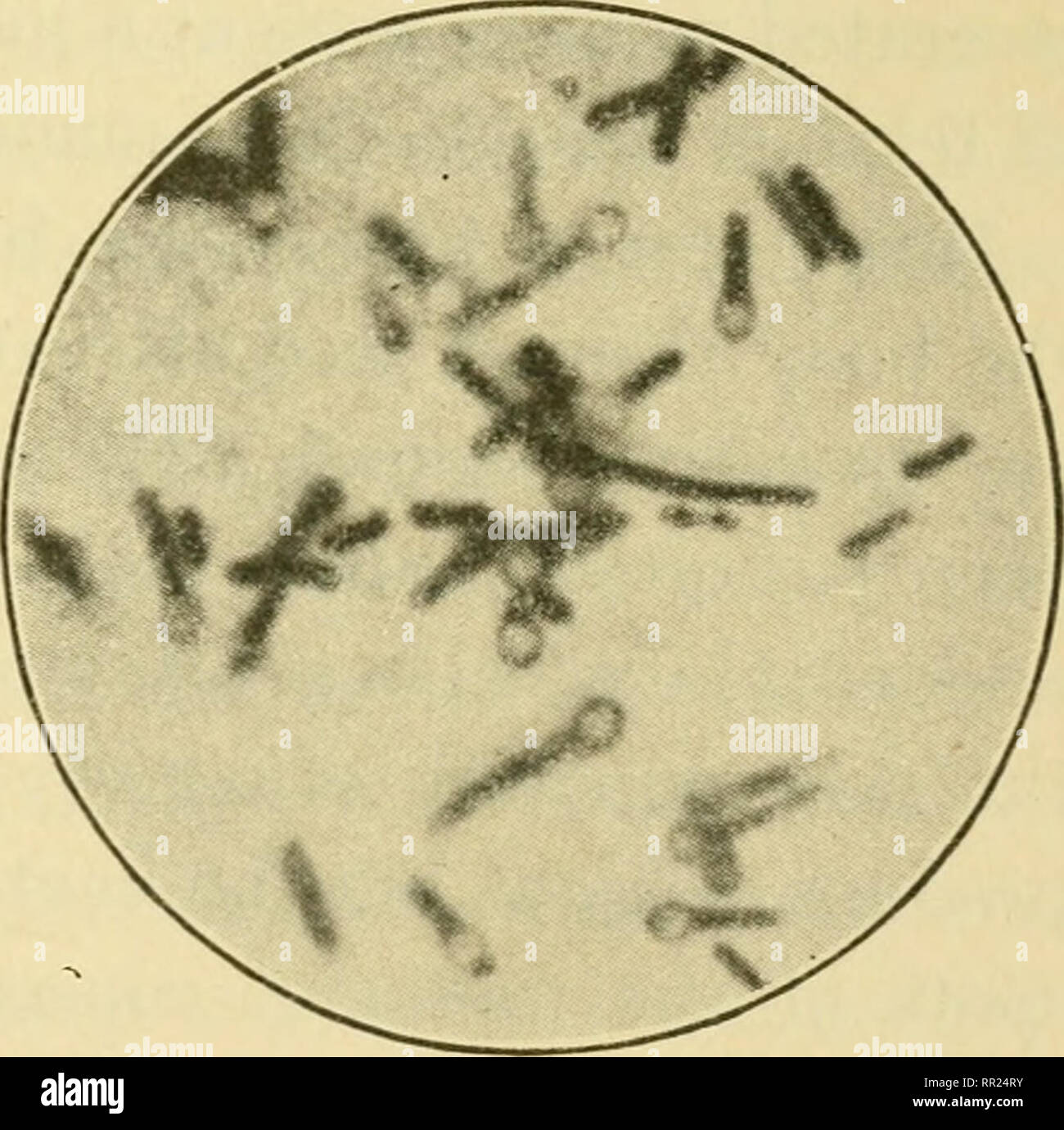 Dissertation tetanus 07 picture