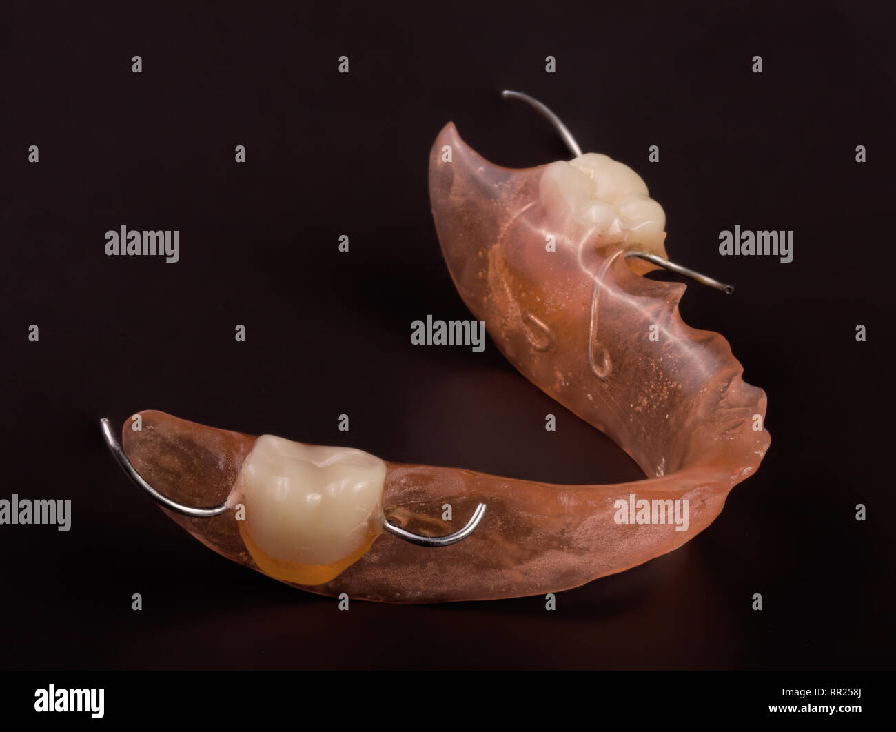 removable partial denture on a dark background Stock Photo Alamy