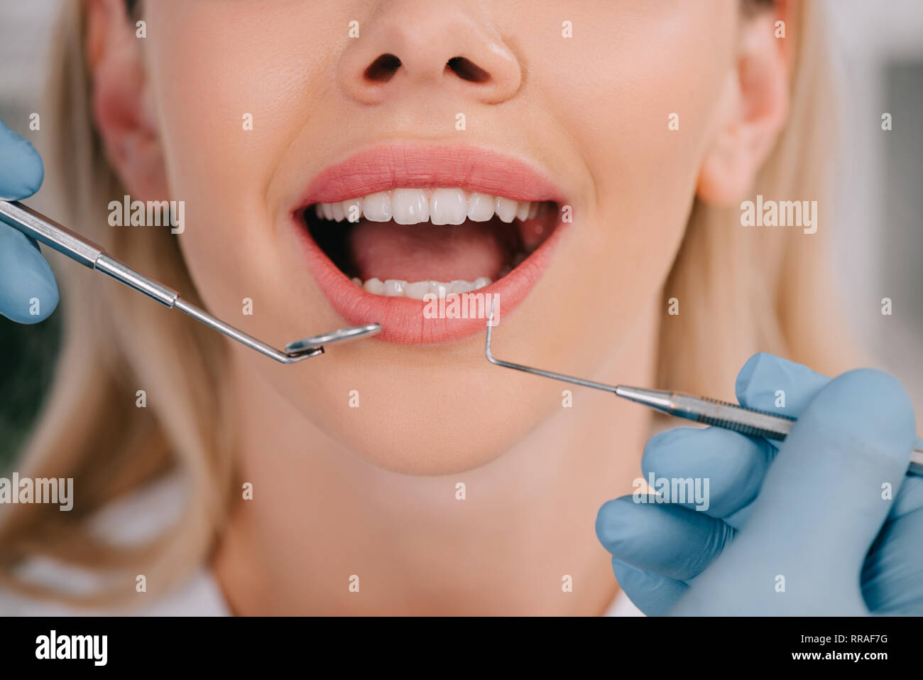 cropped view of dentist examining teeth of young woman with mouth mirror and dental probe Stock Photo