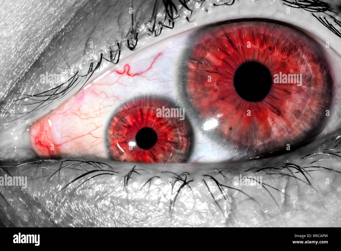 Human eye with two pupils and red tight veins on protein macro close-up texture background. Two unnatural human eyes in one. Stock Photo