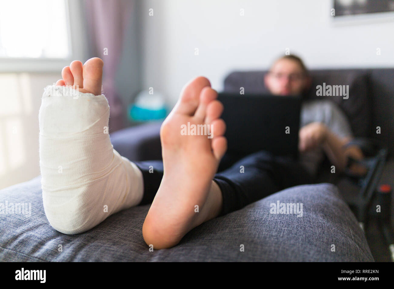 Man waits for him to heal his broken leg Stock Photo Alamy