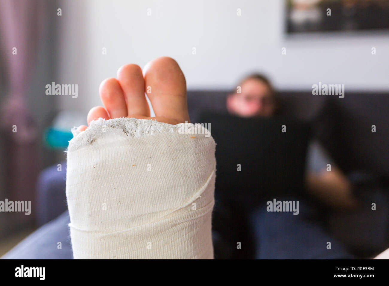 Man at home with broken leg - close up Stock Photo