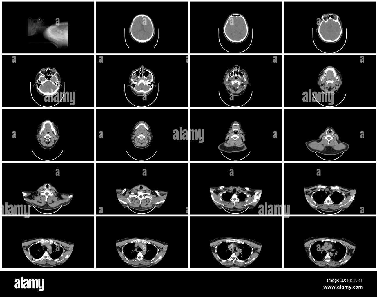 Axial ct scan hi-res stock photography and images - Alamy