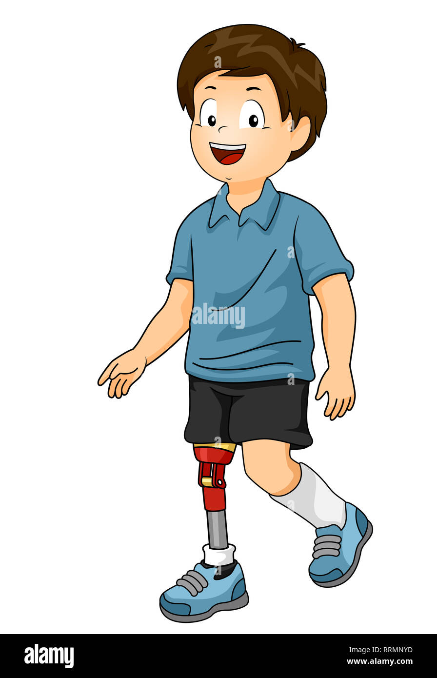 Illustration of a Kid Boy Walking with a Prosthetic Leg Stock Photo Alamy
