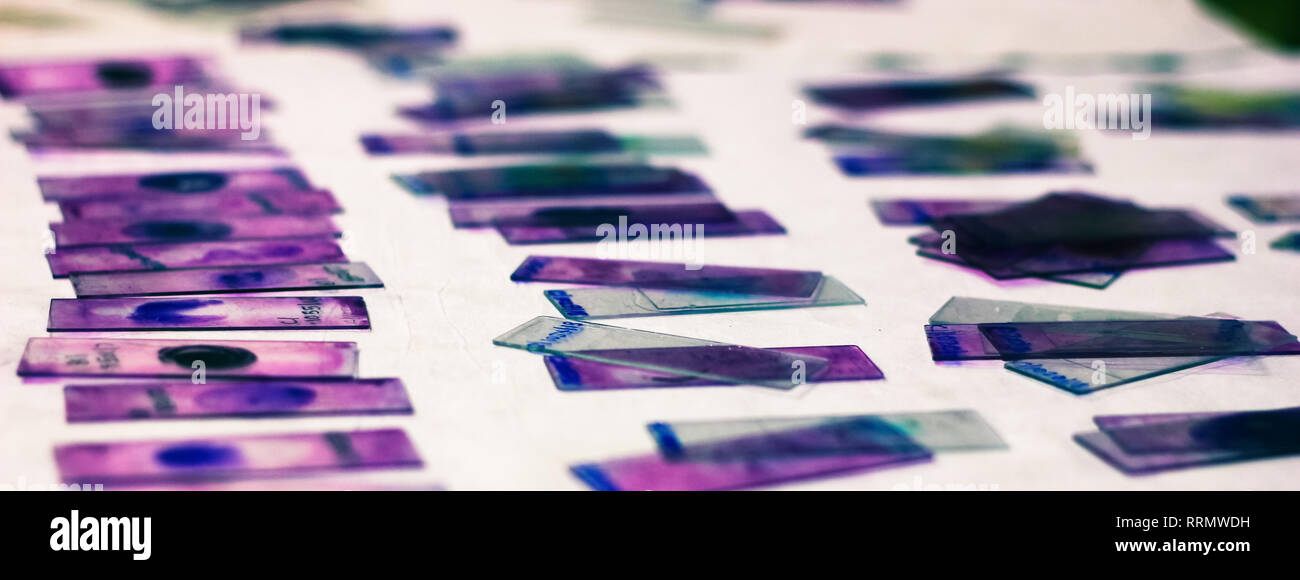 stained glass slides of peripheral blood smear with violet leishman