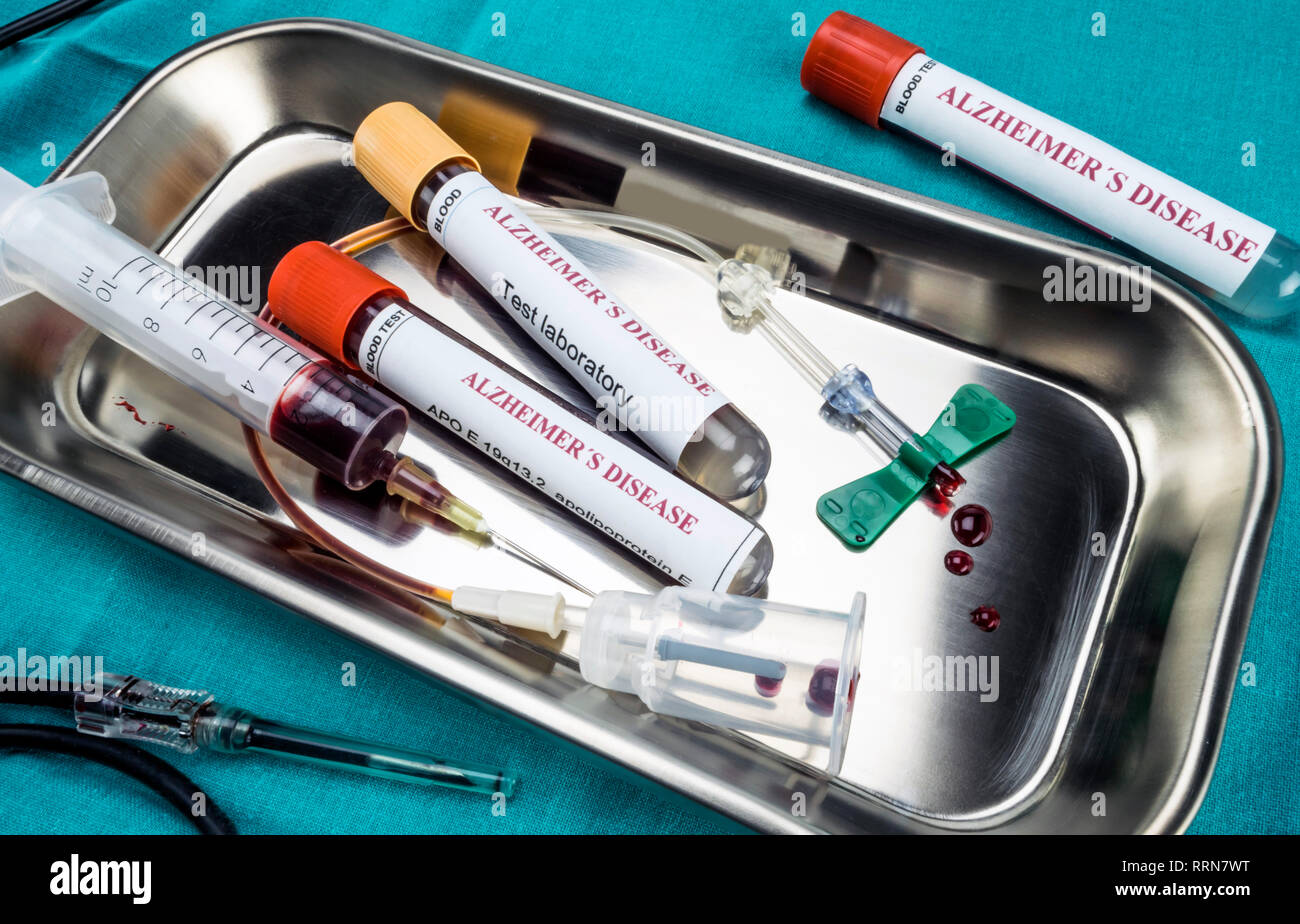 blood sample to investigate remedy against Alzheimer's disease, conceptual image Stock Photo