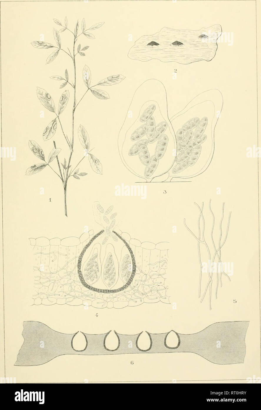 . Atti. Plants; Plants -- Italy; Cryptogamia; Mycology. Alli dell'Isi: Bot Â° UniversilÃ di Pavia Voi VII. Tav.TH.. L' Autore delineo Lib.E.Bruni. Pavia. G.PollaccI- Pleoaphaeruhna Briosiana n.sp.. Please note that these images are extracted from scanned page images that may have been digitally enhanced for readability - coloration and appearance of these illustrations may not perfectly resemble the original work.. Universit di Pavia. Istituto botanico; Universit di Pavia. Laboratorio crittogamico. Pavia [etc. ] : Tip. Fusi [etc. ] Stock Photo
